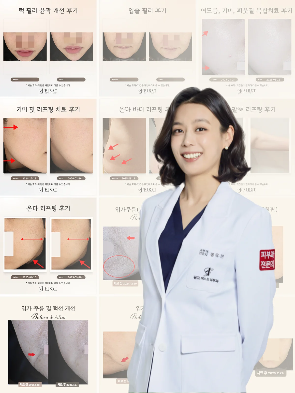광교 퍼스트 피부과 슬로우에이징·볼륨 치료 사례 모음
